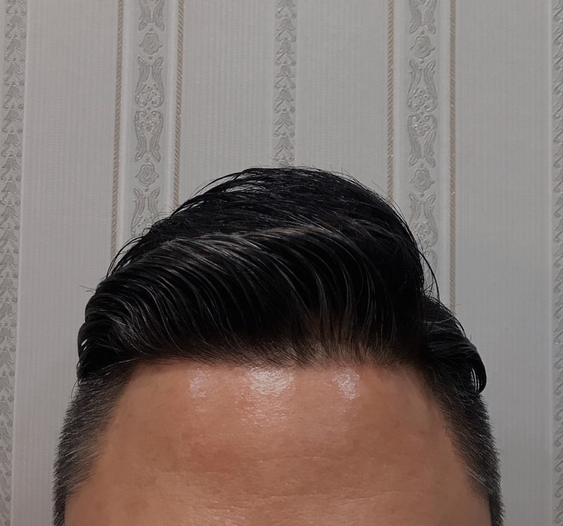 가발평가해주세요