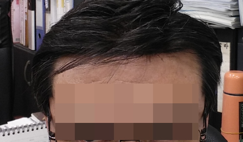 2015년3월16일(15개월)앞라인2.png