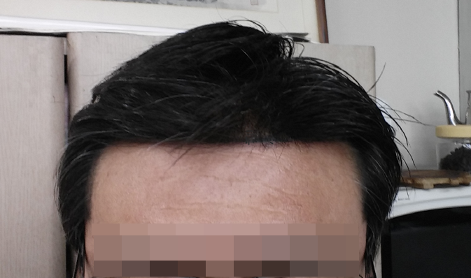 2015년3월16일(15개월)앞라인.png