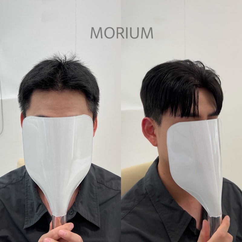 남자 부분 가발