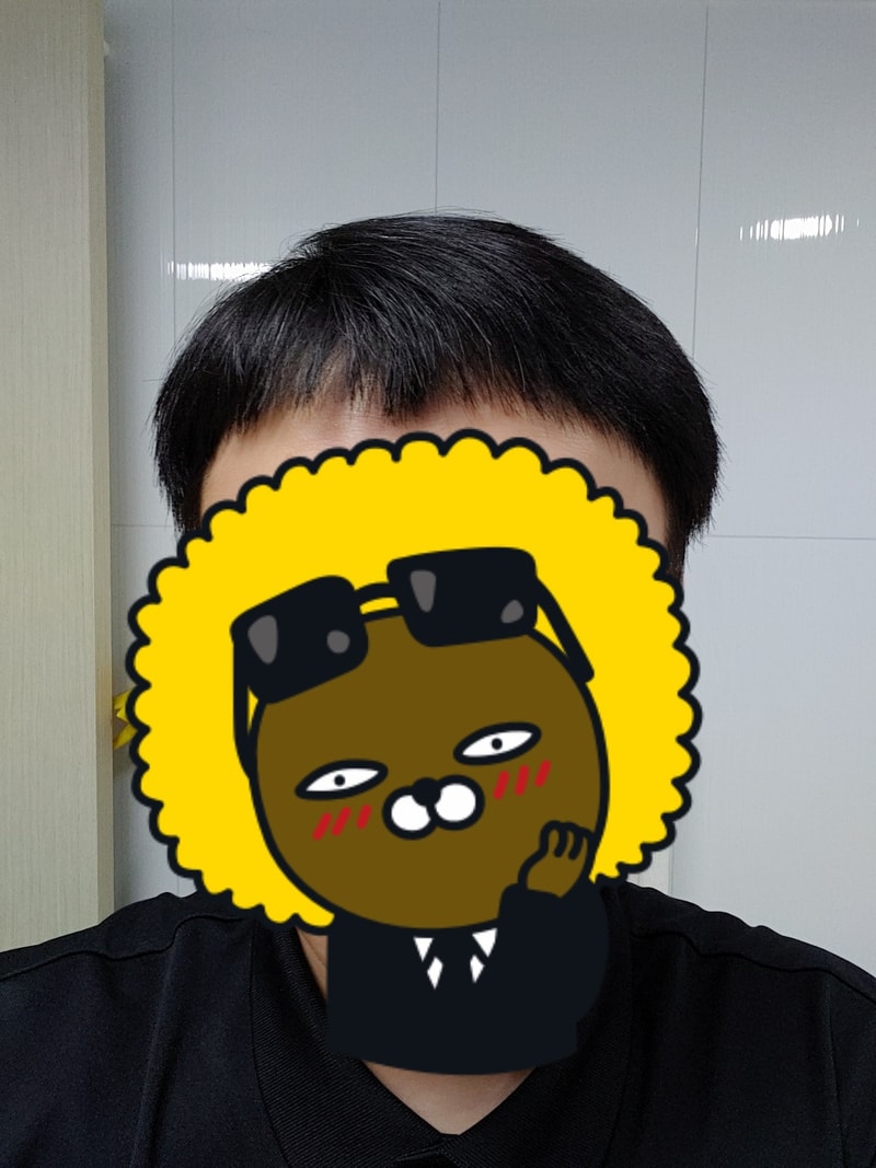 M자 이마, 첫 가발 착용 후기!