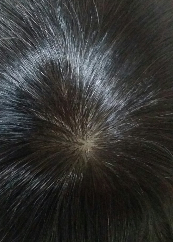 20171019_211101.jpg