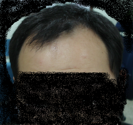 포맷변환_빈대_DSC0802.bmp
