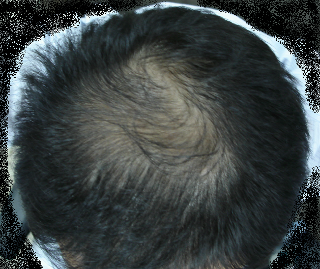 포맷변환_빈대_DSC0828.bmp