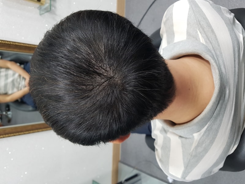 중앙 증모 후.jpeg