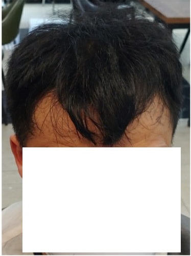 붙임머리 증모 후기 입니다.
