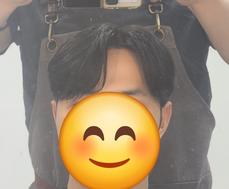 플러스모발  시술후기