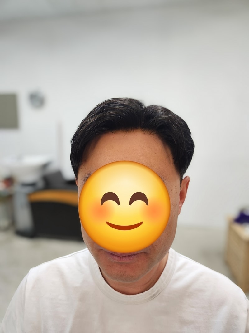 플러스모발센터  시술후기 목동점 8월 프로모션