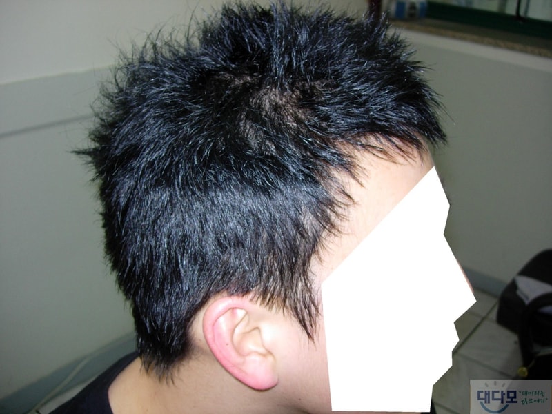 옆모습.JPG
