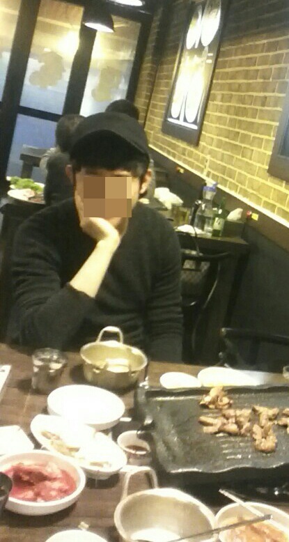 m자 탈모 전용 맞춤가발 후기입니다.