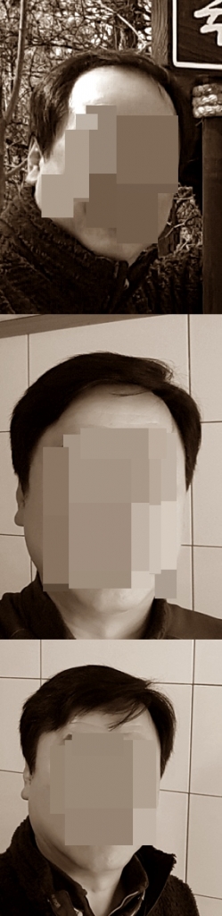 가모착용전후모자이크.jpg