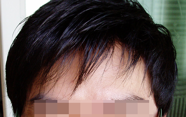 P8180055.jpg
