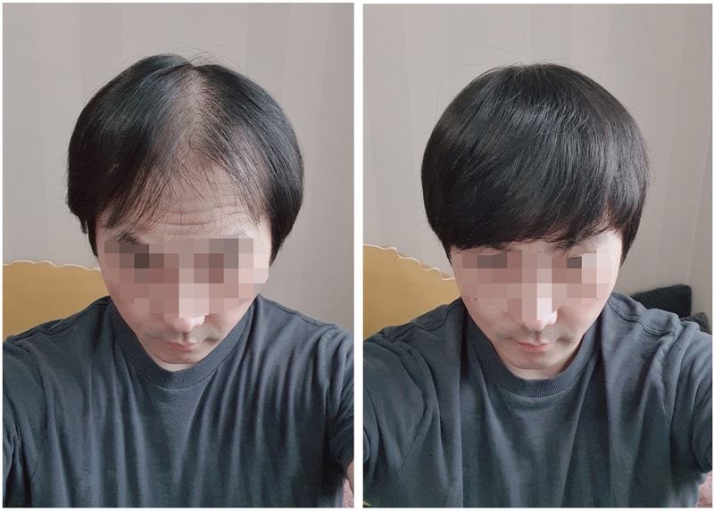밴드형 가발 착용 후기~