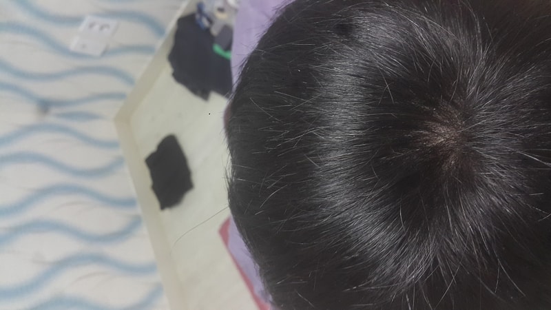 가발도 탈모가 ㅠ