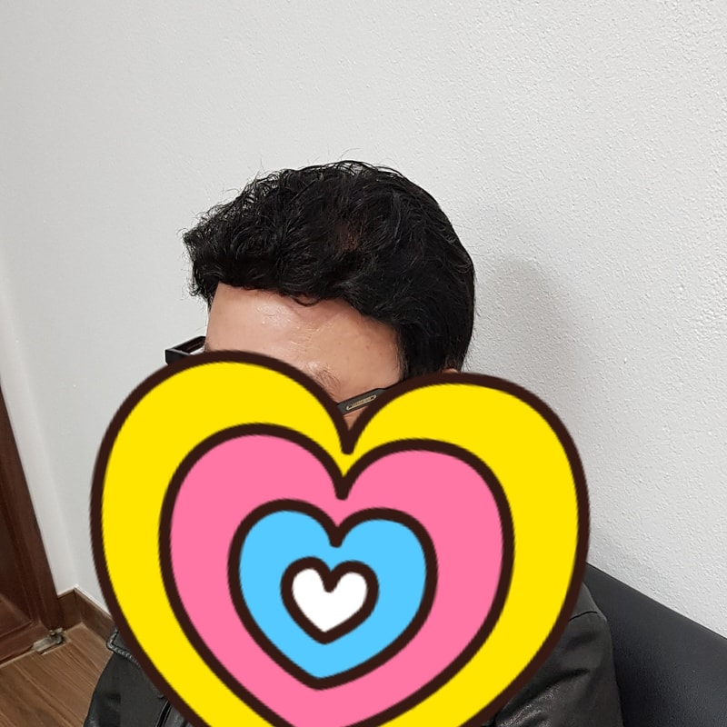 가발착용한지 10년만에 올백스타일가발로 변신