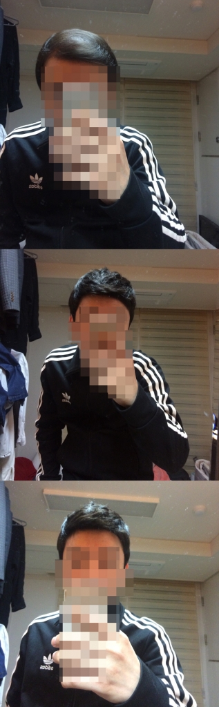 대머리싫다.jpg