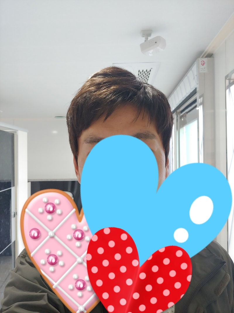 전두 한달 착용 후기