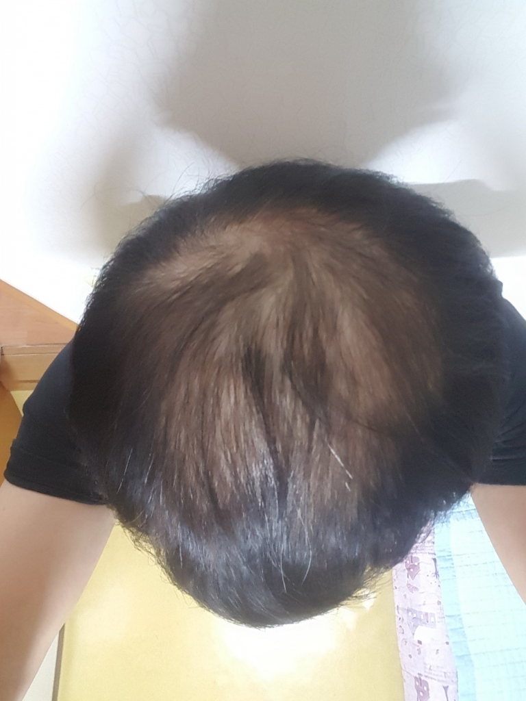 KakaoTalk_20171101_001720970.jpg