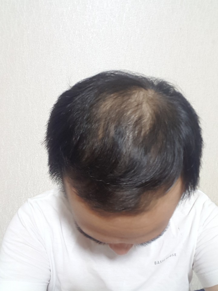 KakaoTalk_20170928_212709663.jpg