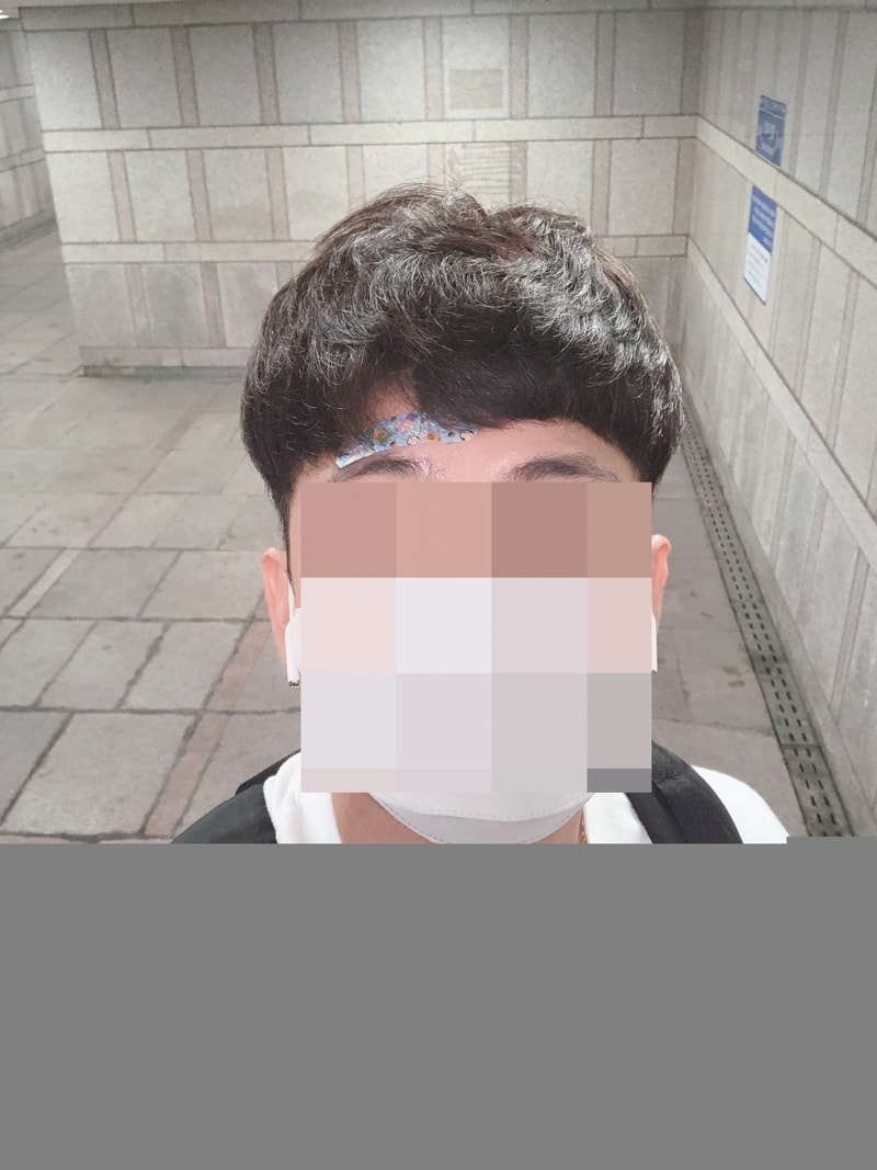 가발 쓴지10년..제 10년 가발모습 모음입니다 ><가발장점단점후기써봅니다