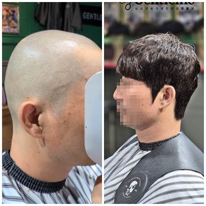 남자전체가발 부천가발 인천가발 젠틀모1.jpg