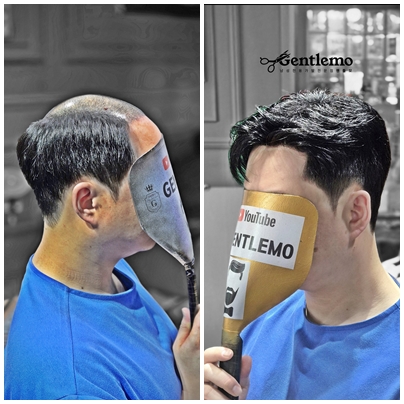 남자가발 가일컷