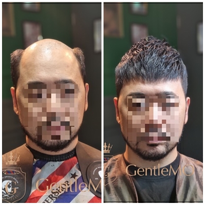 남자가발 짧은남자가발 젠틀모 부천가발 인천가발 서울가발 시흥가발1.jpg