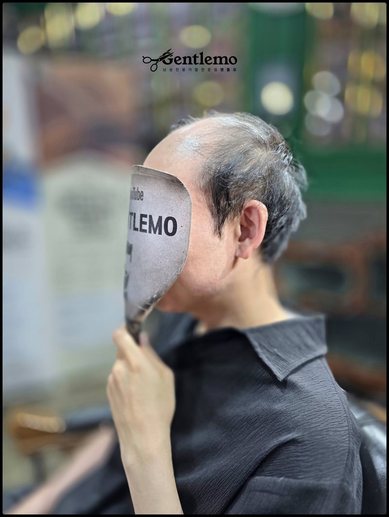 남자가발.남자부분가발.남자가발증모.타사가발.남자전체가발2.jpg
