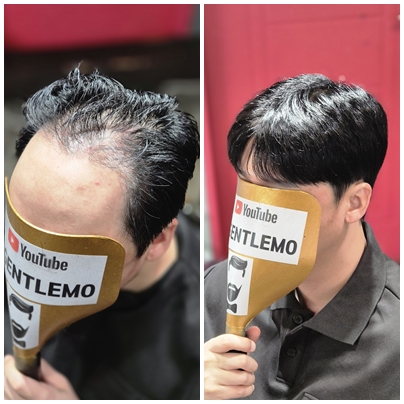남자가발 부천가발 인천가발 젠틀모9.jpg
