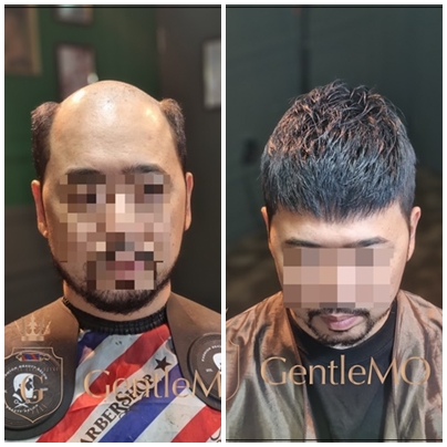 남자가발 짧은남자가발 젠틀모 부천가발 인천가발 서울가발 시흥가발5.jpg
