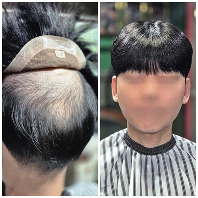 짧은남자가발 부천가발 서울가발 시흥가발 안양가발 젠틀모2.jpg