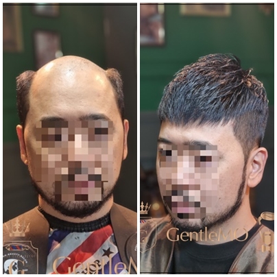 짧은남자가발은 젠틀모