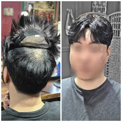 부천가발 인천가발 서울가발 젠틀모 일산가발 안양가발 안산가발.jpg
