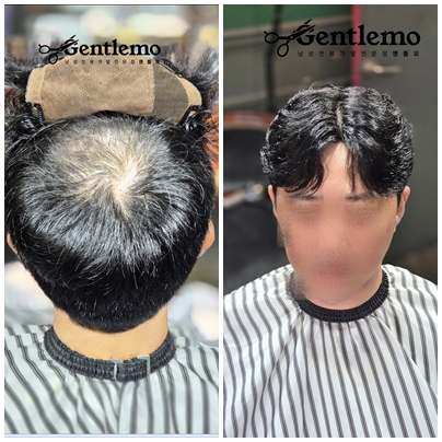 부천가발 인천가발 서울가발 시흥가발 젠틀모5.jpg