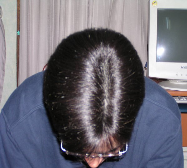 쓴후윗모습2.JPG