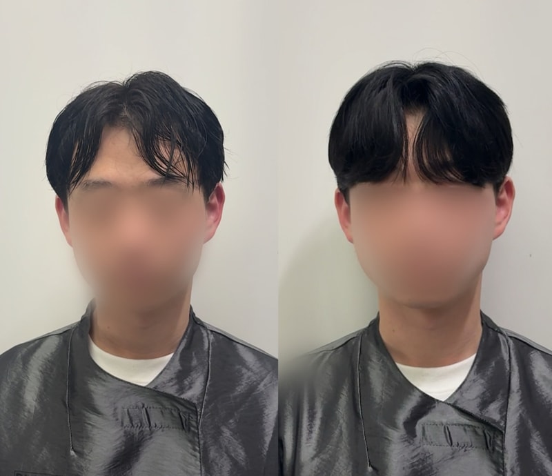 증모술로 자신감 회복~!