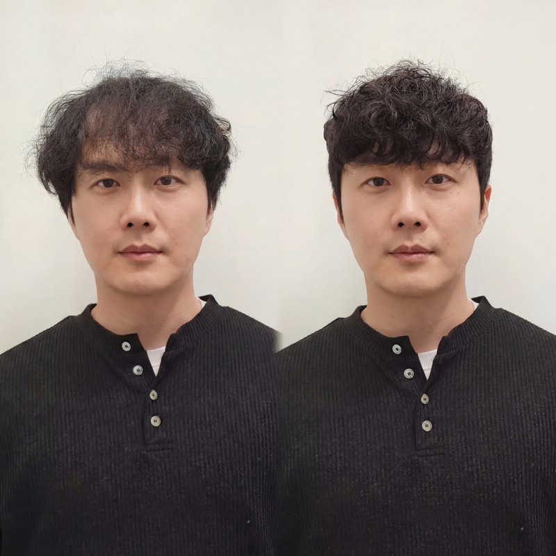 스핀스왈로펌 증모시술로 가능하데요~