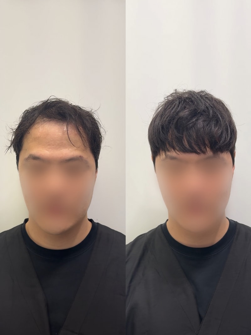 소개팅 준비는 증모술과 함께하세요!