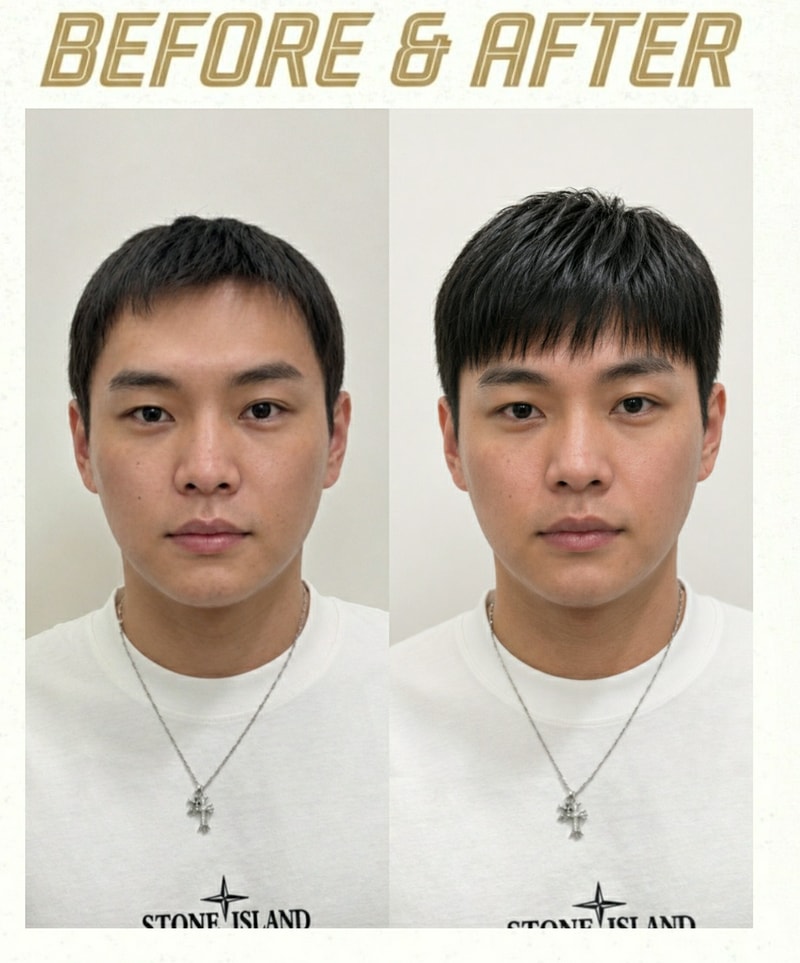 증모술로  길이와 숱 모두 늘려보세요~
