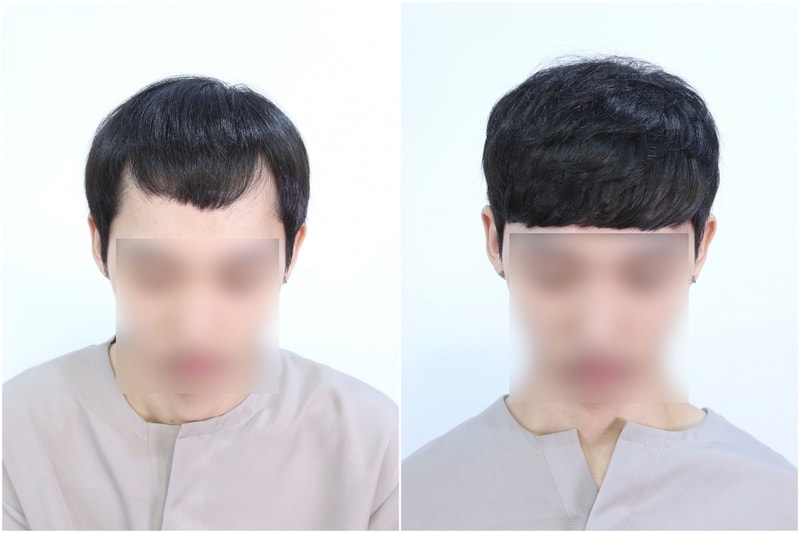 전후.jpg