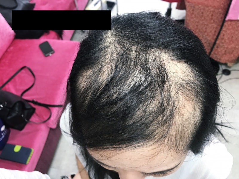 e243271b7dd99af875ef9e7597c6dbc4.jpg