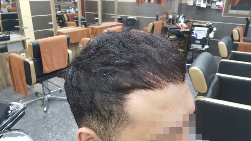 남자앞머리2.jpg