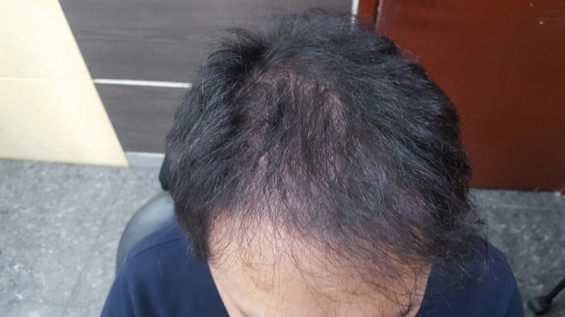 남자앞머리1.jpg