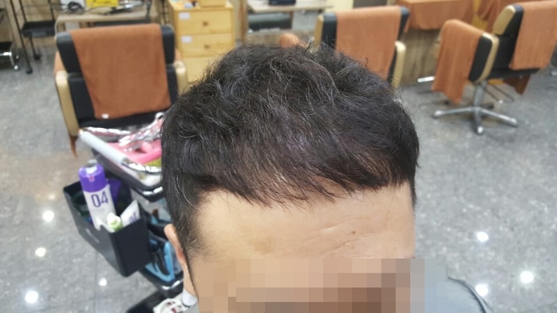 남자앞머리3.jpg