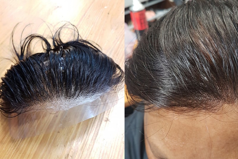 RealScalp.jpg