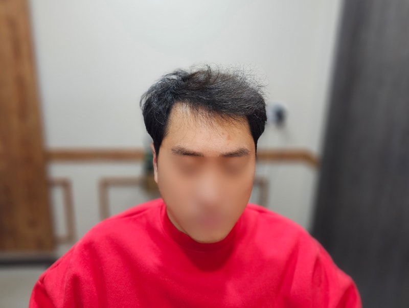 앞머리비포.jpg