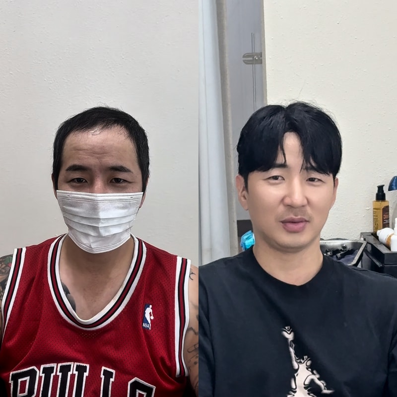 남자 가발 애즈펌