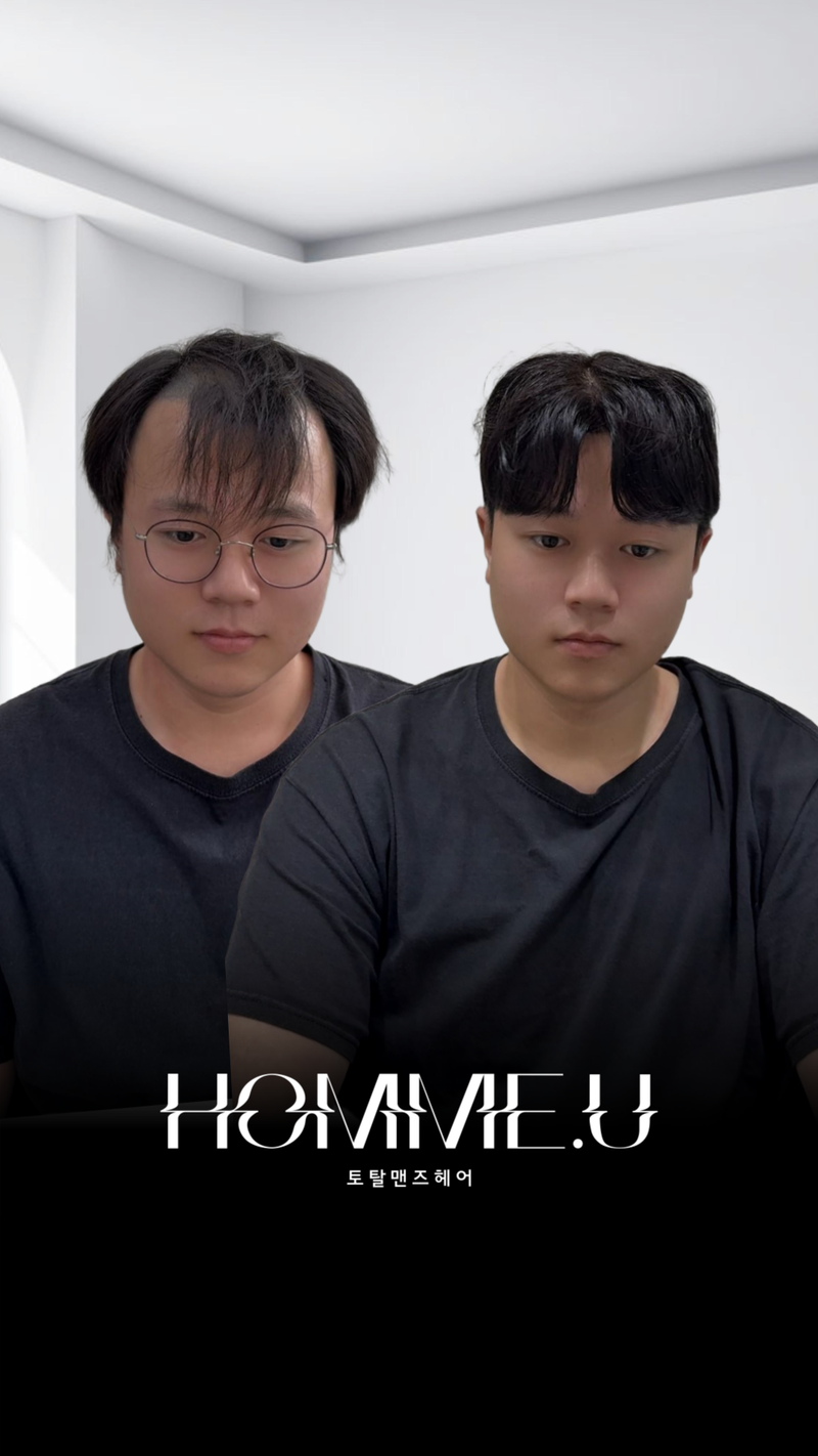 트렌디한 남자가발