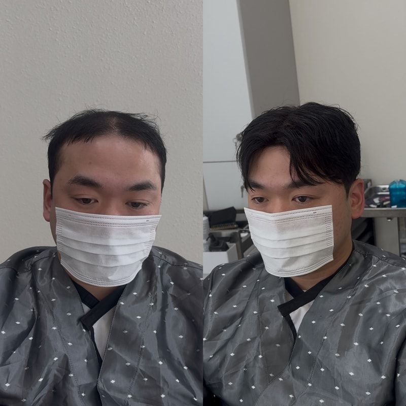 남자 가발 애즈펌