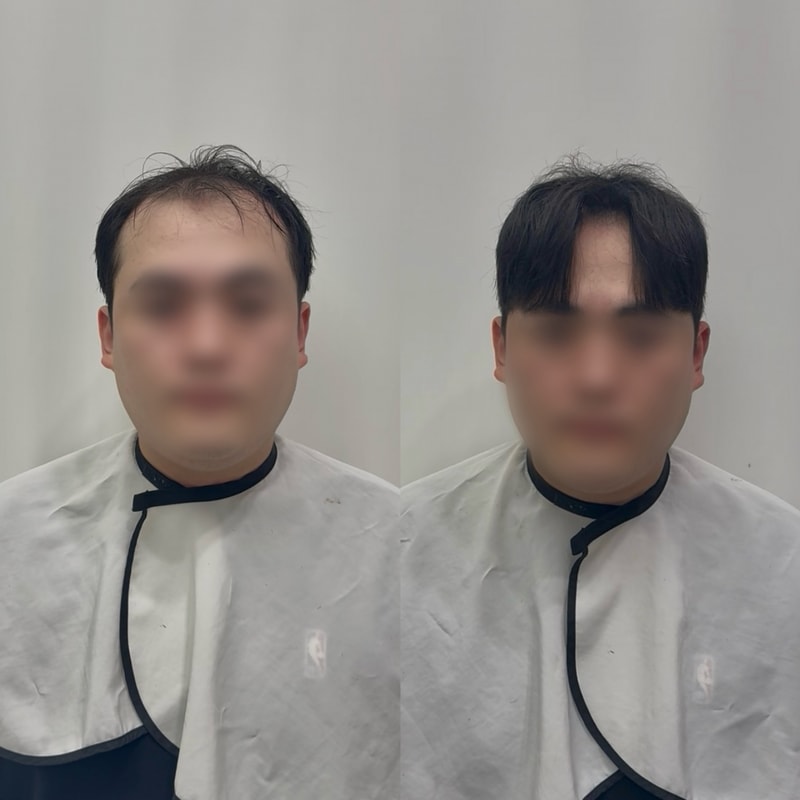 증모술이 없었더라면......